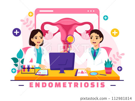 Endometriosis Vector Illustration with Condition the Endometrium Grows Outside the Uterine Wall in Women for Treatment in Flat Cartoon Background 112981814