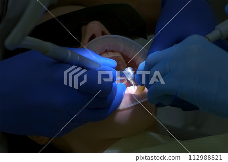 Dentist is preparing woman's teeth for installing ceramic veneers using a drill. Dentist is preparing woman's teeth for installing ceramic veneers using a drill. 112988821