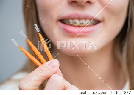Close-up portrait of a woman with braces holding a floss to clean her teeth. Close-up portrait of a woman with braces holding a floss to clean her teeth. 113021827