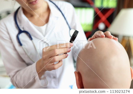 Female doctor looks at skin of bald patient through magnifying glass. 113023274
