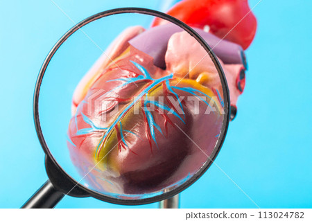 Mockup of a human heart under a magnifying glass on a blue background. Heart examination concept, heart diseases pericarditis, cardiomyopathy and hypertension, close-up Mockup of a human heart under a magnifying glass on a blue background. Heart examination concept, heart diseases pericarditis, cardiomyopathy and hypertension, close-up 113024782