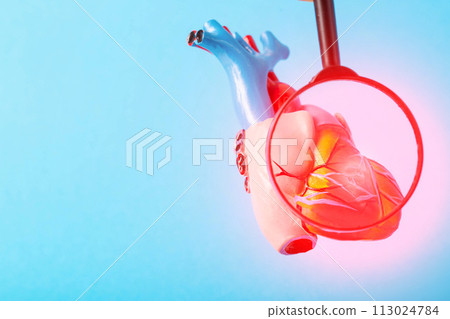 Medical mock-up of a heart under a magnifying glass on a blue background. Heart disease concept, inflammation of the heart muscle, myocardial infarction, coronary heart disease. Copy space for text 113024784