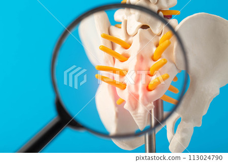 Coccyx and sacrum of the spine mockup on a blue background under a magnifying glass. Concept of degenerative spine diseases, injuries and back pain. Lordosis and lumbago, close-up Coccyx and sacrum of the spine mockup on a blue background under a magnifying glass. Concept of degenerative spine diseases, injuries and back pain. Lordosis and lumbago, close-up 113024790
