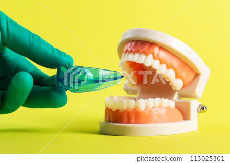 Dental mouthguard and cofferdam in the hand of a dentist doctor against the background of a mock-up of a dental jaw on a yellow background. Concept for the treatment of bruxism, teeth grinding during Dental mouthguard and cofferdam in the hand of a dentist doctor against the background of a mock-up of a dental jaw on a yellow background. Concept for the treatment of bruxism, teeth grinding during 113025301