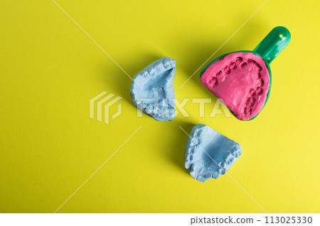 Dental spoon with alginate plastic mass for taking an impression of the dental jaw on a yellow background. Blue plaster dental jaw on a yellow background. Orthodontics in dentistry, manufacturing of Dental spoon with alginate plastic mass for taking an impression of the dental jaw on a yellow background. Blue plaster dental jaw on a yellow background. Orthodontics in dentistry, manufacturing of 113025330