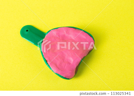 Green dental tray with alginate plastic mass for taking an impression of the dental jaw on a yellow background, isolate. Orthodontics in dentistry, making an impression of the patient s dental jaw, 113025341