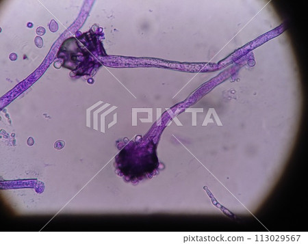 Microscopic observation of mold spores Microscopic observation of mold spores 113029567