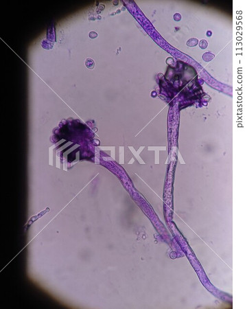 Microscopic photo of mold spores containing moisture Microscopic photo of mold spores containing moisture 113029568