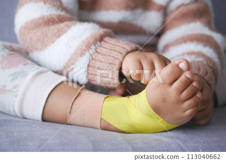 Elastic therapeutic yellow tape applied to child leg. Kinesio Taping therapy for injury 113040662