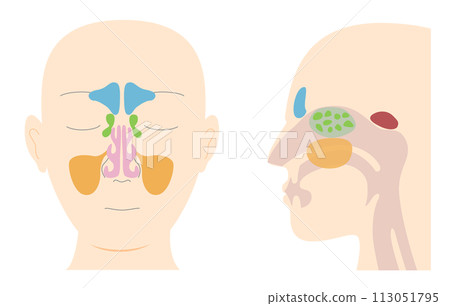 頭部解剖圖,從正面和側面(矢狀面)顯示鼻竇 頭部解剖圖,從正面和側面(矢狀面)顯示鼻竇 113051795