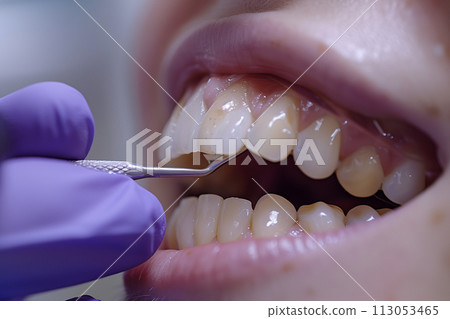 Close Up of Person Brushing Teeth 113053465