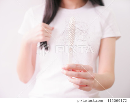 Hair loss 04 Hair loss 04 113069172