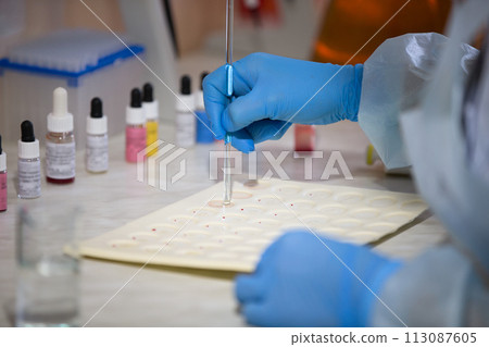 Blood test.Microbiological examination of blood 113087605