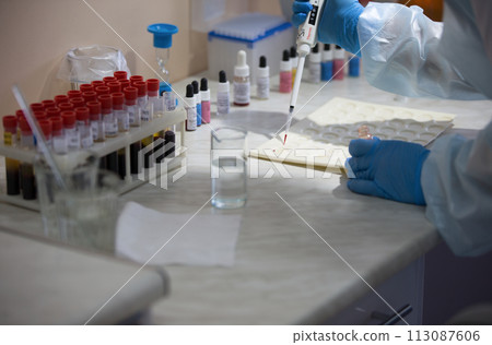 Belarus, Gomel, 24 April 2018. Blood transfusion station.Microbiological examination of blood 113087606