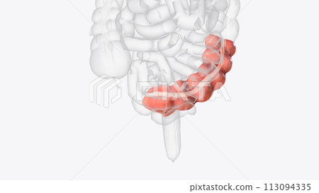 he sigmoid colon is the last part of the colon and connects to the rectum he sigmoid colon is the last part of the colon and connects to the rectum 113094335