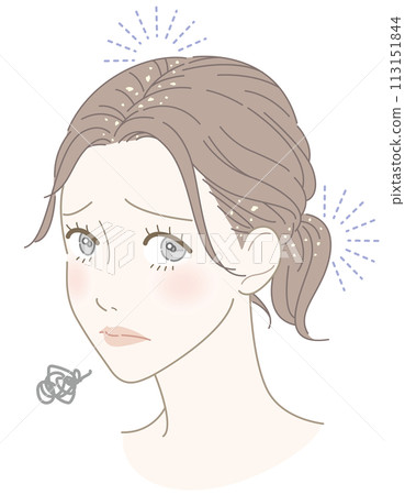 女人頭皮屑煩惱圖 113151844