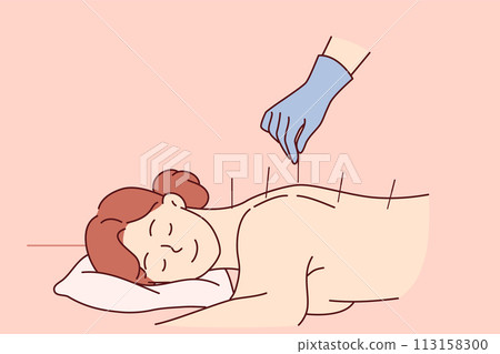 Acupuncture procedure from traditional chinese medicine for woman lying at reception in SPA center Acupuncture procedure from traditional chinese medicine for woman lying at reception in SPA center 113158300