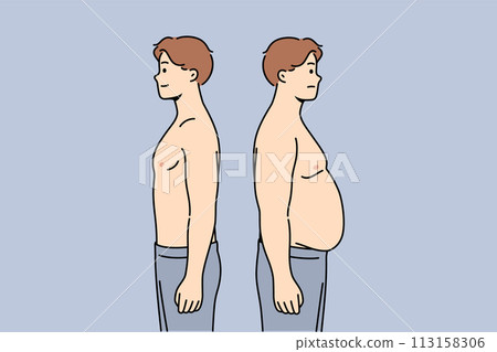 Thin and fat men stand side by side demonstrating changes in figures after eating fast food 113158306
