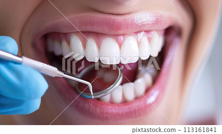 Close up of female mouth with dental mirror. Dentistry concept 113161841