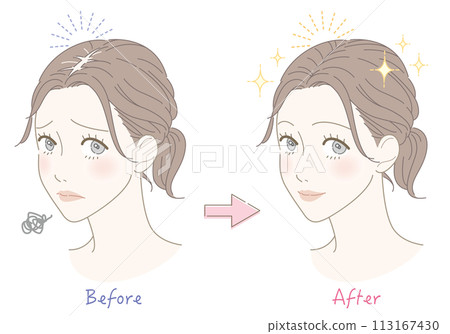 Thinning hair worries before and after woman illustration 113167430