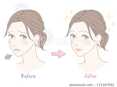 頭皮屑擔心女人前後插畫 113167692