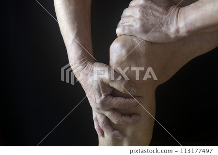 一位患有膝蓋疼痛的老人的膝蓋 113177497