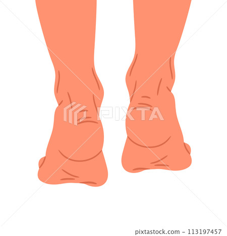 Barefoot legs back view. Woman walks or sneaks on tiptoes, female naked feet, bare pair of legs flat vector illustration. Hand drawn feet on white Barefoot legs back view. Woman walks or sneaks on tiptoes, female naked feet, bare pair of legs flat vector illustration. Hand drawn feet on white 113197457