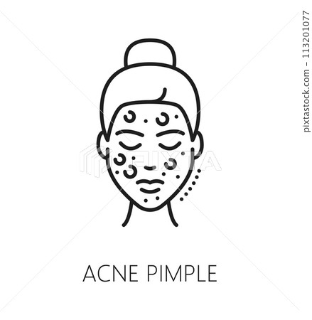 Face care cosmetology and mesotherapy, skin acne pimple, skincare health line icon. Facial skin health problem treatment and skincare cosmetics outline vector symbol with woman face covered acne Face care cosmetology and mesotherapy, skin acne pimple, skincare health line icon. Facial skin health problem treatment and skincare cosmetics outline vector symbol with woman face covered acne 113201077