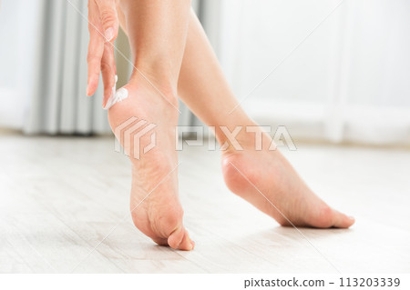 A woman applying cream to the heel of her foot. 113203339