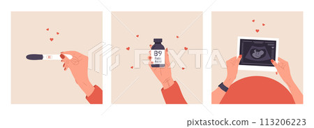 Set of happy pregnancy vector illustration. Female hands holding fetus silhouette photo, positive pregnancy test, vitamin B9. Ultrasound of baby. Belly top view. Flat cartoon style 113206223