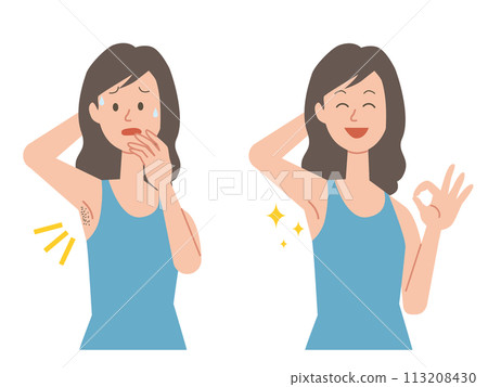 一名女性患有多餘頭髮的前後對比圖 一名女性患有多餘頭髮的前後對比圖 113208430