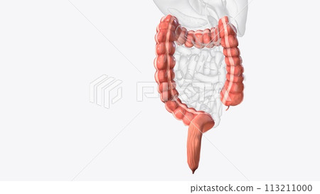 The colon is also known as the large bowel or large intestine 113211000