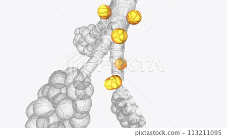 Alveoli are tiny, balloon-shaped air sacs located at the end of the bronchioles, the branch-like tubes in the lungs Alveoli are tiny, balloon-shaped air sacs located at the end of the bronchioles, the branch-like tubes in the lungs 113211095