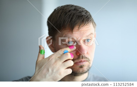 Man scratches his face with a dirty hand near his eye Man scratches his face with a dirty hand near his eye 113252584