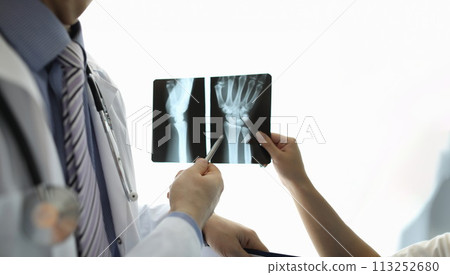 Surgeon pointing to x-ray Surgeon pointing to x-ray 113252680