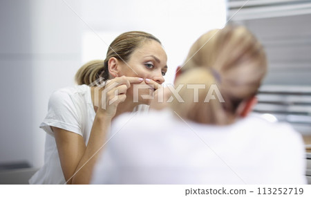 Young woman stands in front of mirror and presses pimples with hands portrait 113252719