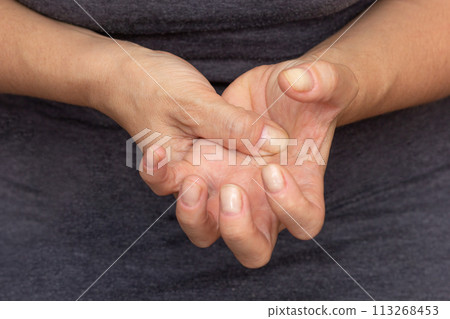 Woman hands showing numb hand 113268453