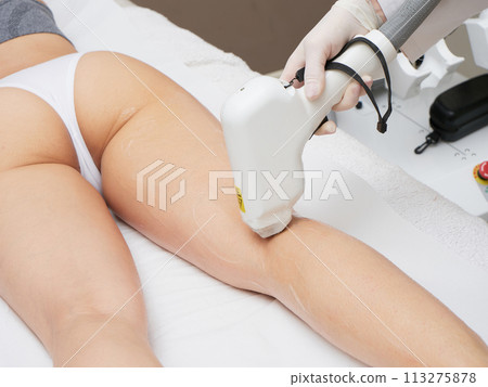 Beautician Removing Hair  113275878