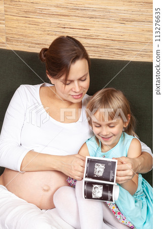 Expectant Mother and Daughter Looking at Ultrasound 113276635