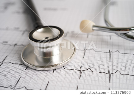 Stethoscope on electrocardiogram ECG, heart wave, heart attack, cardiogram report. 113276903