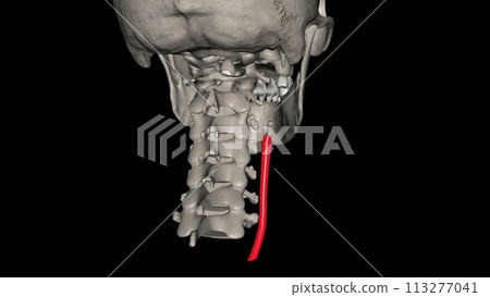 Right common carotid artery Right common carotid artery 113277041