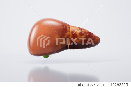 Liver organ with fatty liver state, 3d rendering. Liver organ with fatty liver state, 3d rendering. 113292535
