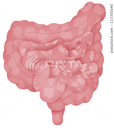 Intestine 113305840