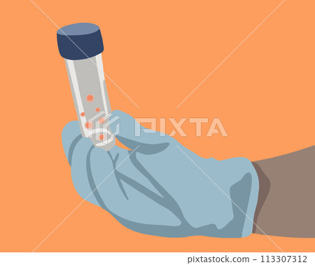 Vector isolated illustration of eggs in a test tube. Egg donation. Egg freezing. Vector isolated illustration of eggs in a test tube. Egg donation. Egg freezing. 113307312