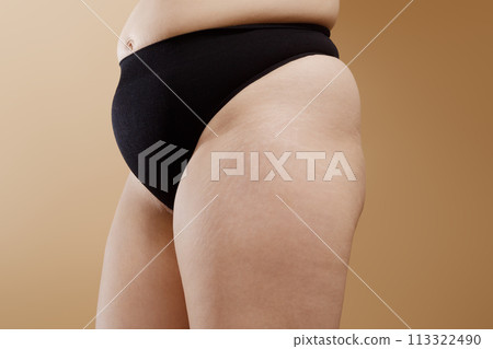 Unaltered , natural skin and body with stretch 113322490