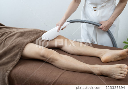 一名男子正在接受男士除毛治療 113327894