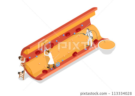 3D Isometric Flat  Conceptual Illustration of High Cholesterol 113334028