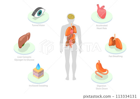3D Isometric Flat  Conceptual Illustration of Stress Response 113334131