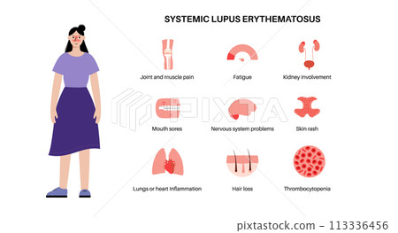 Systemic lupus erythematosus 113336456