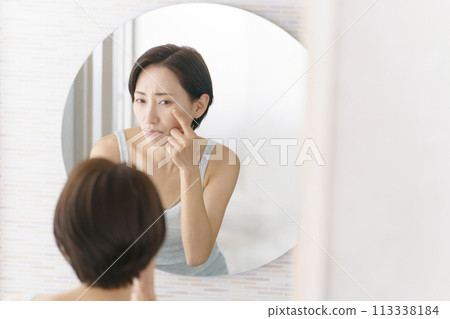 Middle-aged women suffering from skin problems Middle-aged women suffering from skin problems 113338184